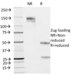 Cytokeratin 19 Antibody (KRT19/799), Novus Biologicals 0.2mg; Unlabeled:Antibodies,